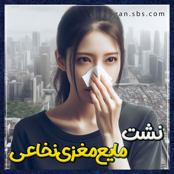 نشت مایع مغزی نخاعی + انجمن جراحان قاعده جمجمه ایران