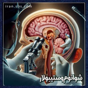شوانوم وستیبولار _ انجمن جراحان قاعده جمجمه