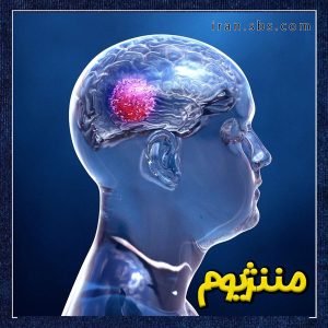 مننژیوم + انجمن جراحان قاعده جمجمه