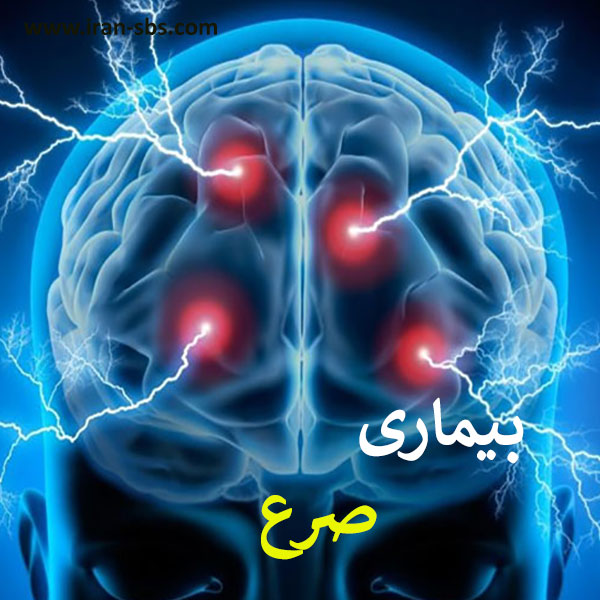 درمان قطعی صرع _ انجمن جراحان قاعده جمجمه