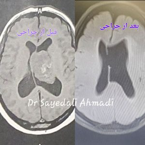 عمل قاعده جمجمه _ iran.sbs.com