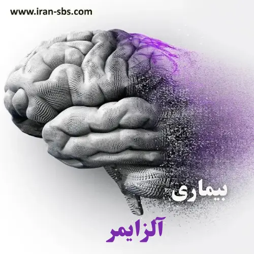 آلزایمر - انجمن جراحان قاعده جمحمه