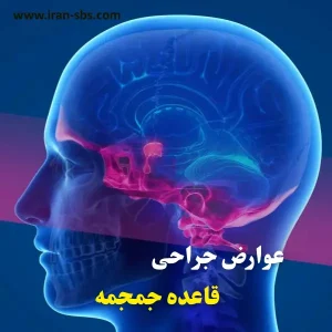 عوارض جراحی قاعده جمجمه _ انجمن جراحان قاعده جمجمه