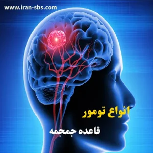 انواع تومور قاعده جمجمه _ انجمن جراحان قاعده جمجمه