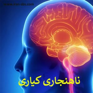 ناهنجاری کیاری - جراحان قاعده جمجمه -iran-sbs.com