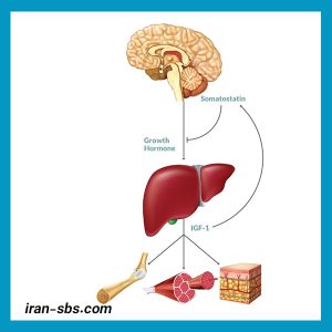 IGF-1 گروه جراحان قاعده جمجمه - iran-sbs.com