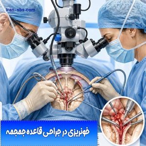 خونریزی در جراحی قاعده جمجمه